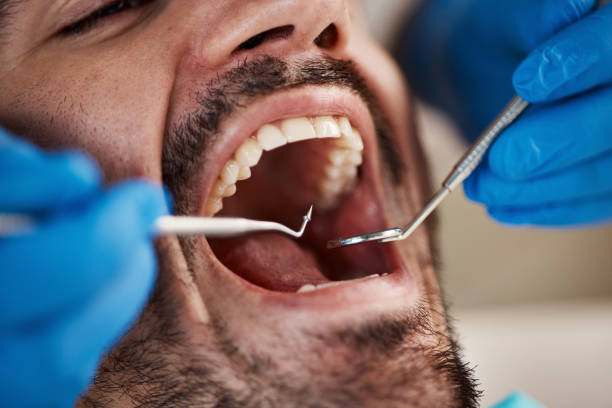 Best Urgent Care for Lost Fillings or Crowns in Compton, CA