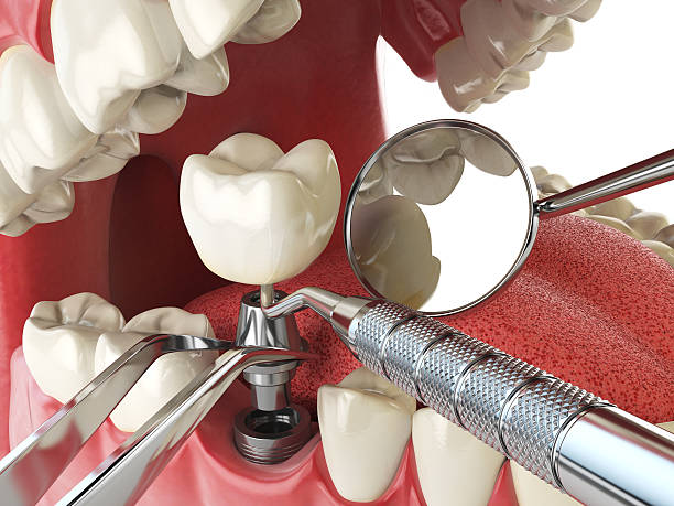 Best Weekend Emergency Dentist in Compton, CA